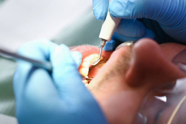 Best Emergency Dental Services for Seniors in Kensington Park, FL